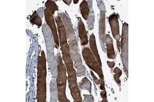 Immunohistochemical staining of human skeletal muscle with RWDD2B polyclonal antibody  shows strong cytoplasmic positivity in a heterogeneous staining pattern. (RWDD2B antibody)