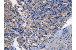 IHC-P analysis of Mouse Stomach Tissue, with DAB staining. (TMEM27 antibody  (Leu222))