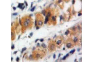 Used in DAB staining on fromalin fixed paraffin-embedded Stomach tissue (MUC5B antibody  (AA 5366-5444))