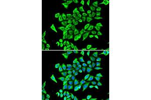 Immunofluorescence analysis of A549 cell using LCN2 antibody. (Lipocalin 2 antibody  (AA 21-198))