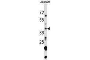 SNAPC1 Antibody (Center) western blot analysis in Jurkat cell line lysates (35µg/lane). (SNAPC1 antibody  (Middle Region))