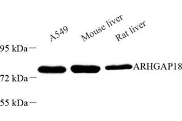ARHGAP18 antibody