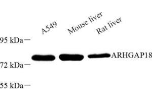 Western blot analysis of ARHGAP18 (ABIN7075417) at dilution of 1: 600