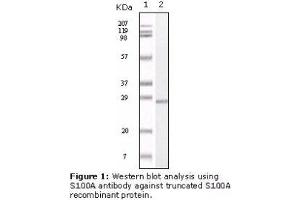 Image no. 2 for anti-S100 Calcium Binding Protein A1 (S100A1) antibody (ABIN232125) (S100A1 antibody)