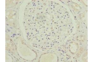 Immunohistochemistry of paraffin-embedded human kidney tissue using ABIN7175021 at dilution of 1:100 (C5orf24 antibody  (AA 7-188))