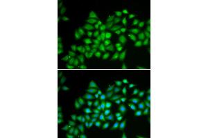 Immunofluorescence analysis of HeLa cell using ATP2A2 antibody. (ATP2A2 antibody)