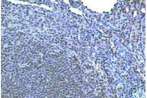 Immunohistochemistry (IHC) image for anti-Chemokine (C-C Motif) Receptor 10 (CCR10) antibody (ABIN2477947) (CCR10 antibody)
