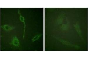 Immunofluorescence analysis of HeLa cells, using PDGFR alpha (Ab-762) Antibody.