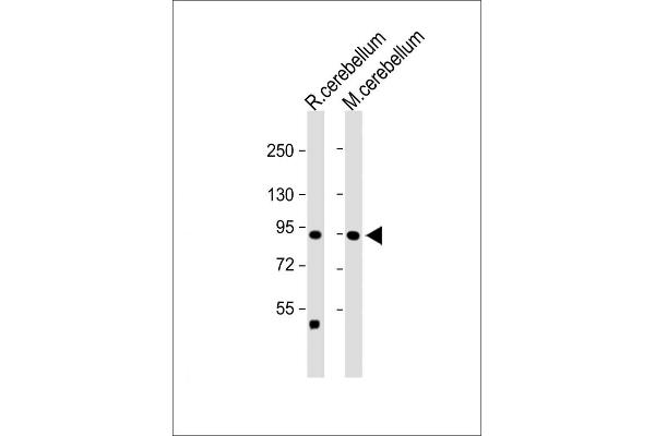 TRPV1 antibody  (N-Term)