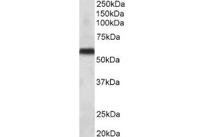 Western Blotting (WB) image for anti-Cytochrome P450, Family 2, Subfamily C, Polypeptide 8 (CYP2C8) antibody (ABIN5898160) (CYP2C8 antibody)