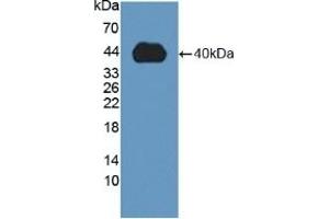 Detection of Recombinant MMP23B, Human using Polyclonal Antibody to Matrix Metalloproteinase 23B (MMP23B) (MMP23B antibody  (AA 79-390))