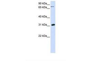 Image no. 1 for anti-Uridine Phosphorylase 1 (UPP1) (N-Term) antibody (ABIN6738021) (UPP1 antibody  (N-Term))