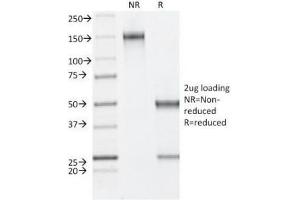 SDS-PAGE Analysis of Purified, BSA-Free Estrogen Receptor beta Antibody (clone ESR2/686). (ESR2 antibody  (C-Term))