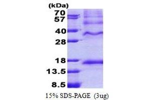SDS-PAGE (SDS) image for Inhibin, beta C (INHBC) (AA 237-352) protein (His tag) (ABIN6387244) (INHBC Protein (AA 237-352) (His tag))