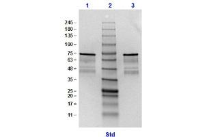 SDS-PAGE (SDS) image for Surface Lipoprotein p27 protein (ABIN5624579)
