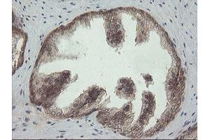 Image no. 1 for anti-Phosphoinositide-3-Kinase, Catalytic, gamma Polypeptide (PIK3CG) antibody (ABIN1500207) (PIK3 gamma antibody)