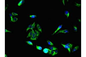 Immunofluorescent analysis of Hela cells using ABIN7166245 at dilution of 1:100 and Alexa Fluor 488-congugated AffiniPure Goat Anti-Rabbit IgG(H+L) (UNC13C antibody  (AA 414-645))