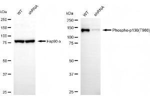 Western blotting analysis using phospho-p130 (T986) antibody (ABIN7799666). (Recombinant NOLC1 antibody  (pThr986))