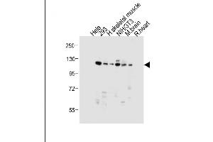 All lanes : Anti-Dnmt3a Antibody at 1:1000 dilution Lane 1: Hela whole cell lysate Lane 2: 293 whole cell lysate Lane 3: Human skeletal muscle tissue lysate Lane 4: NIH/3T3 whole cell lysate Lane 5: Mouse brain tissue lysate Lane 6: Rat heart tissue lysate Lysates/proteins at 20 μg per lane. (DNMT3A antibody  (AA 457-486))