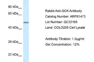 Western Blotting (WB) image for anti-Glucokinase (Hexokinase 4) (GCK) (N-Term) antibody (ABIN2788816) (GCK antibody  (N-Term))