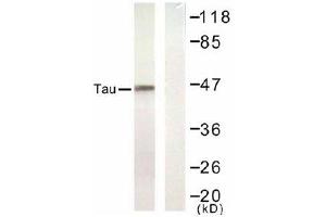 Image no. 1 for anti-Microtubule-Associated Protein tau (MAPT) (Ser422) antibody (ABIN197528) (MAPT antibody  (Ser422))