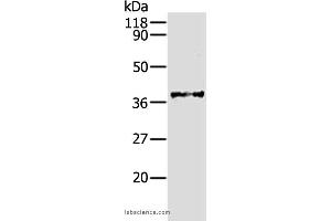 Western blot analysis of Hela cell, using AKR1B1 Polyclonal Antibody at dilution of 1:340 (AKR1B1 antibody)