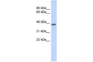 Western Blotting (WB) image for anti-DDB1 and CUL4 Associated Factor 4-Like 1 (DCAF4L1) antibody (ABIN2459760) (DCAF4L1 antibody)