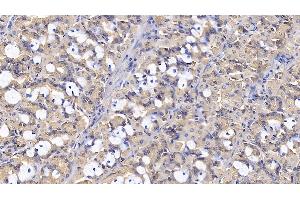 Detection of IL1RA in Human Stomach Tissue using Monoclonal Antibody to Interleukin 1 Receptor Antagonist (IL1RA) (IL1RN antibody  (AA 26-177))