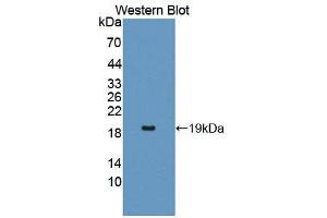 Western blot analysis of the recombinant protein. (IL17RA antibody  (AA 377-534))