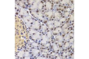 Immunohistochemistry of paraffin-embedded rat pancreas using MCM4 Antibody (ABIN5971548) at dilution of 1/200 (40x lens). (MCM4 antibody)