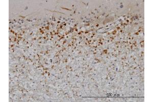 Immunoperoxidase of monoclonal antibody to PTN on formalin-fixed paraffin-embedded human cerebellum.