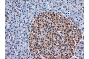 Immunohistochemical staining of paraffin-embedded Human Kidney tissue using anti-TACC3 mouse monoclonal antibody. (TACC3 antibody)