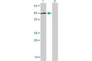 Western Blot analysis of LEF1 expression in transfected 293T cell line by LEF1 monoclonal antibody (M01), clone 3H5.