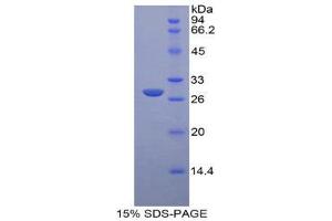 SDS-PAGE (SDS) image for Glucuronidase, beta (GUSB) (AA 440-648) protein (His tag) (ABIN2124978)
