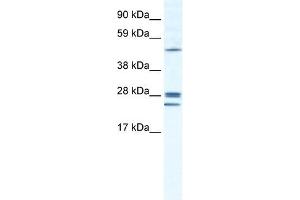 GJB2 antibody used at 1. (GJB2 antibody  (N-Term))