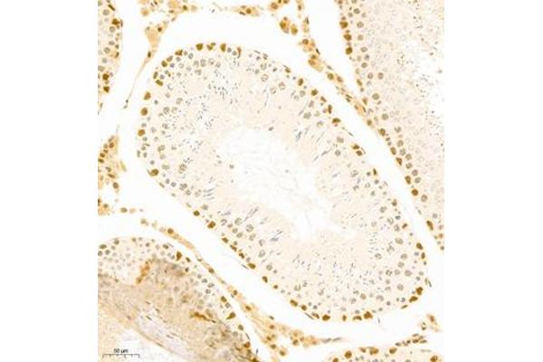 MED17 antibody