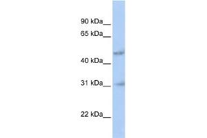 WB Suggested Anti-ABT1 Antibody Titration:  0. (Activator of Basal Transcription 1 antibody  (N-Term))