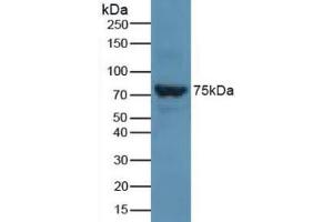 Detection of SLC27A5 in Rat Liver Tissue using Polyclonal Antibody to Solute Carrier Family 27 Member 5 (SLC27A5) (SLC27A5 antibody  (AA 488-690))