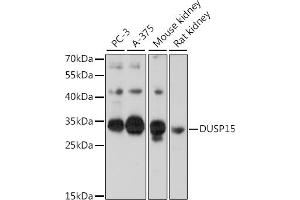 Western blot analysis of extracts of various cell lines, using DUSP15 antibody (ABIN7266846) at 1:1000 dilution. (DUSP15 antibody  (AA 10-90))