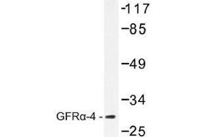Image no. 1 for anti-GDNF Family Receptor alpha 4 (GFRA4) antibody (ABIN317910)