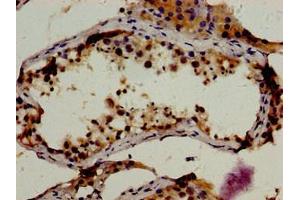 Immunohistochemistry of paraffin-embedded human testis tissue using ABIN7167841 at dilution of 1:100 (RBP1 antibody  (AA 70-112))