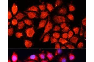Immunofluorescence analysis of HeLa cells using MRPS28 Polyclonal Antibody at dilution of 1:100 (40x lens).