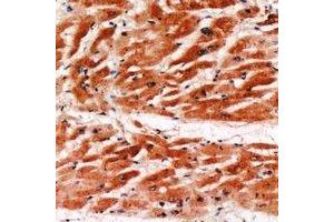 Immunohistochemical analysis of MYBPC3 staining in human heart formalin fixed paraffin embedded tissue section. (MYBPC3 antibody)