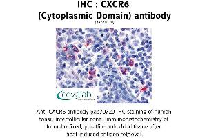Image no. 1 for anti-Chemokine (C-X-C Motif) Receptor 6 (CXCR6) (2nd Cytoplasmic Domain) antibody (ABIN1733413)