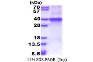 SDS-PAGE (SDS) image for RAD51 Homolog D (RAD51D) (AA 1-328) protein (His tag) (ABIN6387376)
