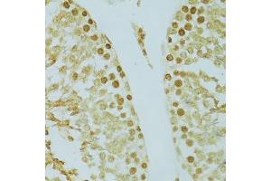 Immunohistochemistry of paraffin-embedded rat testis using RCC1 antibody (ABIN5973761) at dilution of 1/100 (40x lens). (RCC1 antibody)
