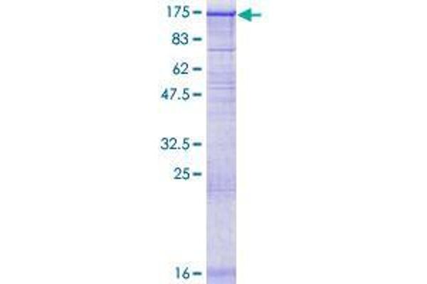 EPC1 Protein (AA 1-813) (GST tag)