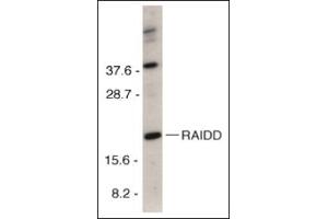 Western blot analysis of RAIDD in HeLa total cell lysate with this product at 1 μg/ml. (CRADD antibody  (C-Term))