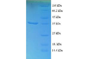 SDS-PAGE (SDS) image for Eukaryotic Translation Elongation Factor 1 delta (Guanine Nucleotide Exchange Protein) (EEF1D) (AA 2-281) protein (His tag) (ABIN4975981) (EEF1D Protein (AA 2-281) (His tag))