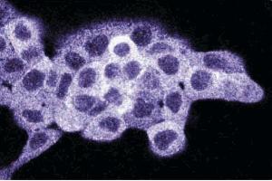 Immunofluorescence staining on A431 cells (Human epithelial carcinoma, ATCC CRL-1555). (Dynamin 1-Like antibody  (AA 19-201))